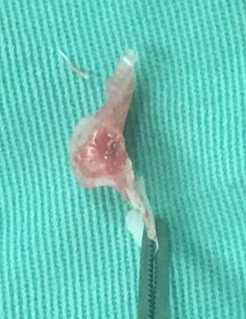 20200326_200326_0001_副本.jpg 20200326_200326_0001_副本.jpg