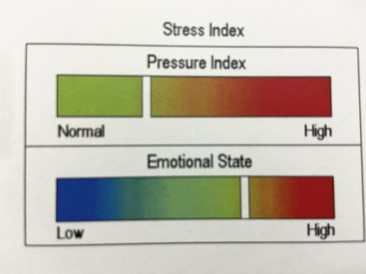 /tmp/phpEuMb7O /tmp/phpEuMb7O