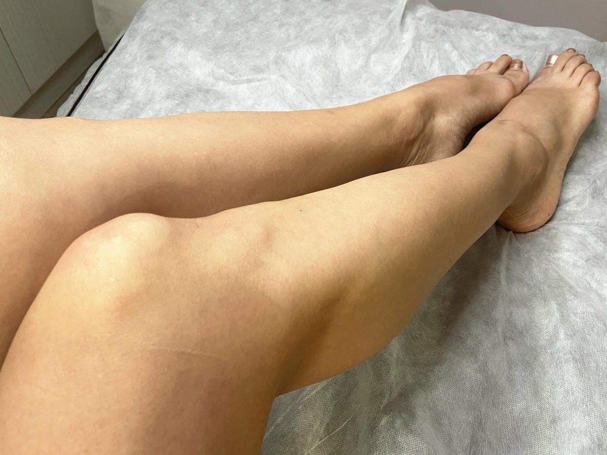 絢全身除毛 (58).jpg 絢全身除毛 (58).jpg