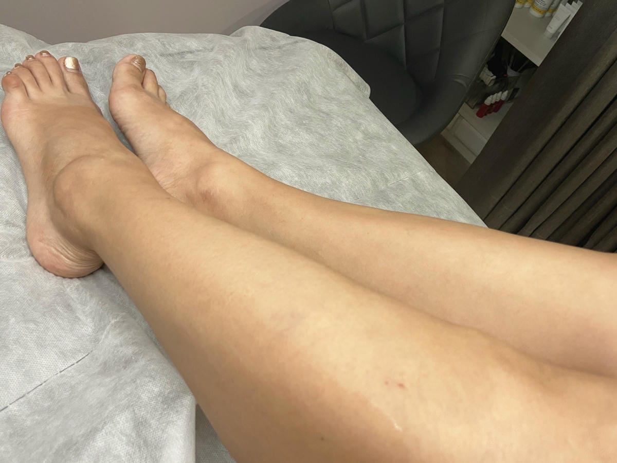 絢全身除毛 (61).jpg 絢全身除毛 (61).jpg