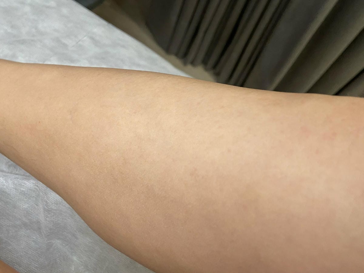 絢全身除毛 (60).jpg 絢全身除毛 (60).jpg