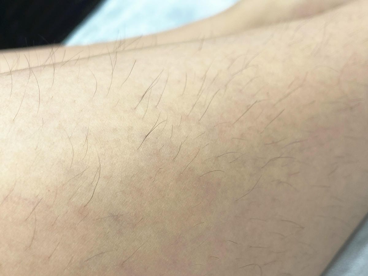 絢全身除毛 (25).jpg 絢全身除毛 (25).jpg