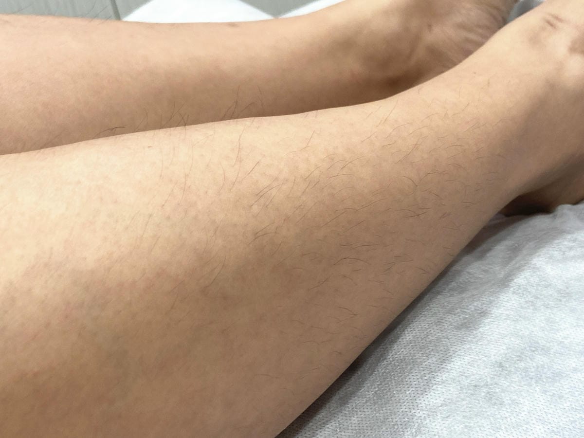 絢全身除毛 (24).jpg 絢全身除毛 (24).jpg