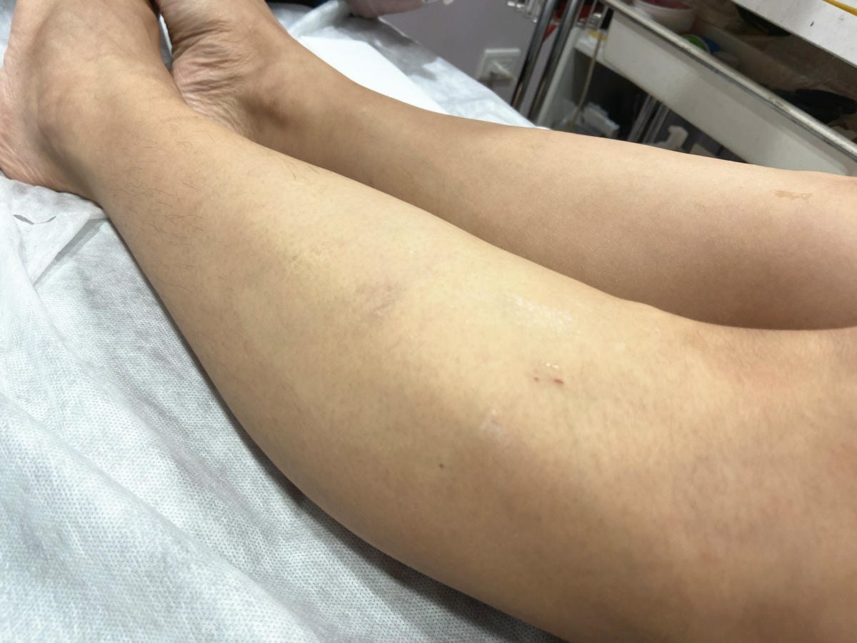 絢全身除毛 (42).jpg 絢全身除毛 (42).jpg