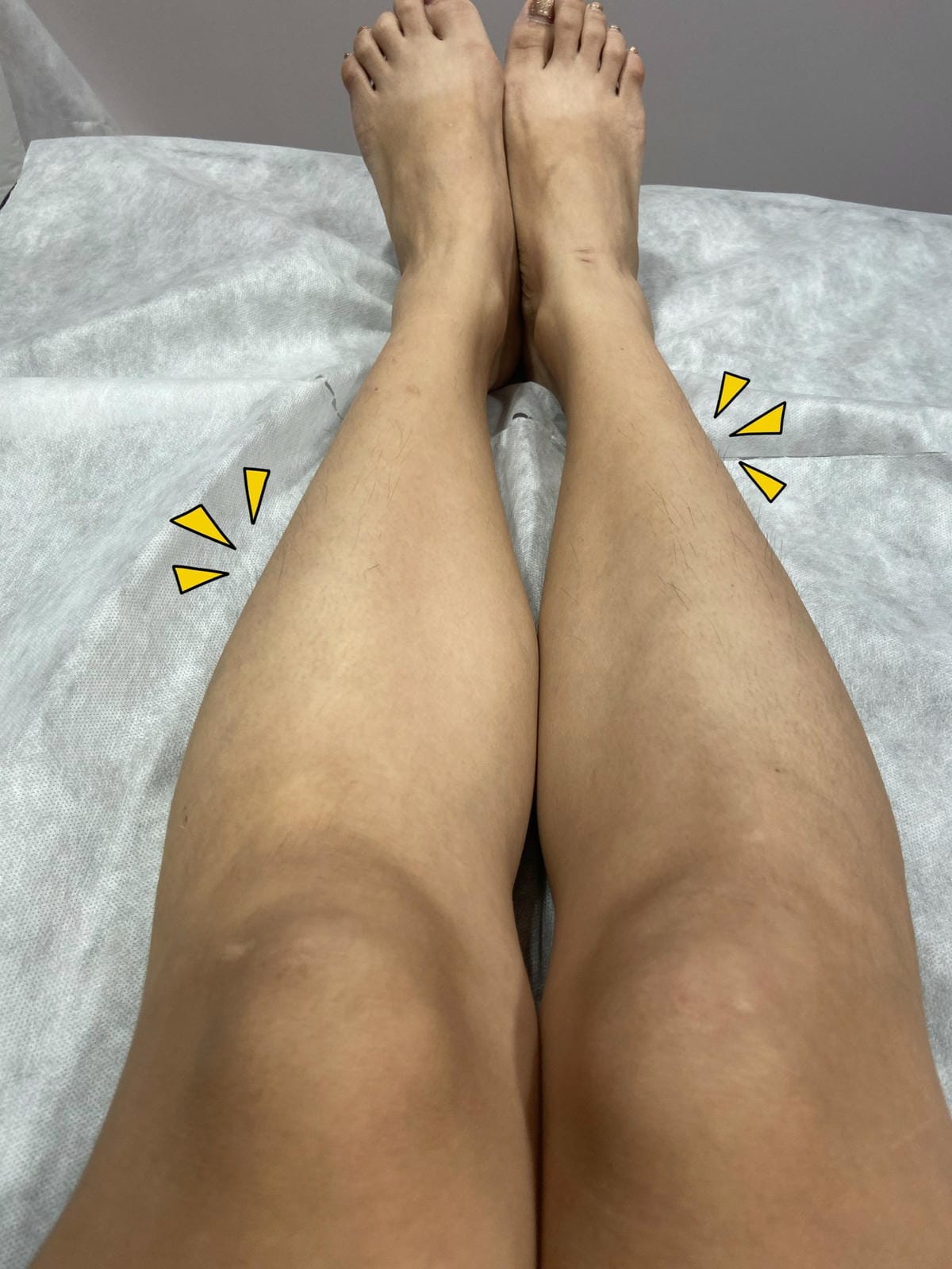 絢全身除毛 (28).jpg 絢全身除毛 (28).jpg