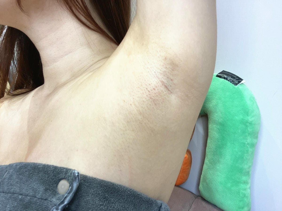 絢全身除毛 (63).jpg 絢全身除毛 (63).jpg