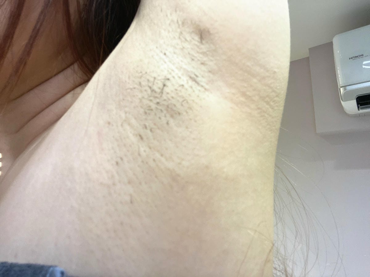 絢全身除毛 (26).jpg 絢全身除毛 (26).jpg