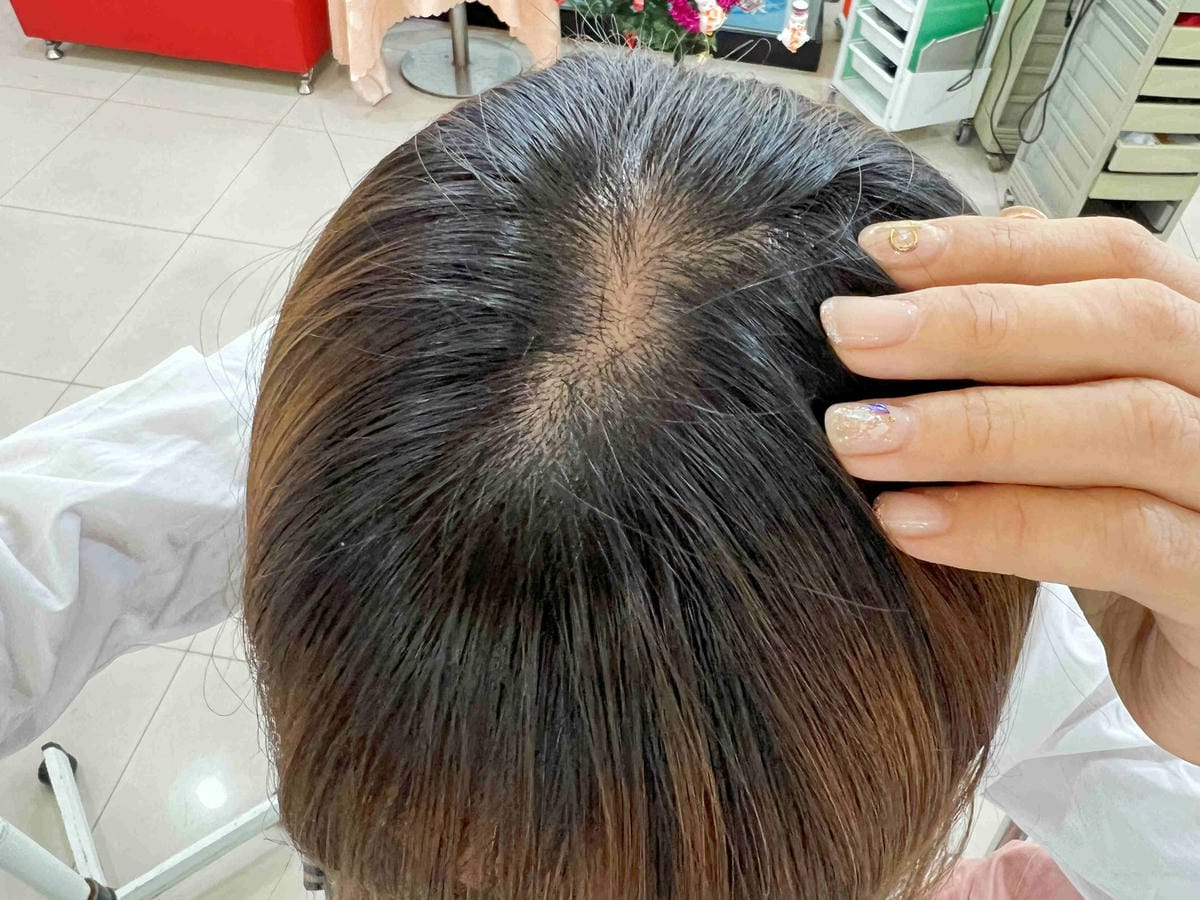 髮胜肽HGP頭皮養髮精華液 (16).jpg 髮胜肽HGP頭皮養髮精華液 (16).jpg