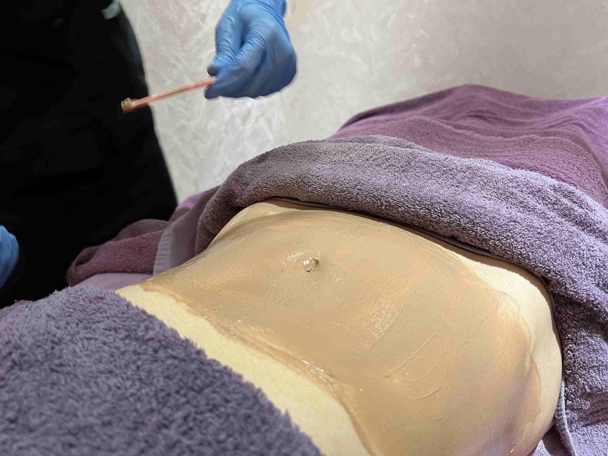 麗波診所皮膚管理 (31).jpg 麗波診所皮膚管理 (31).jpg