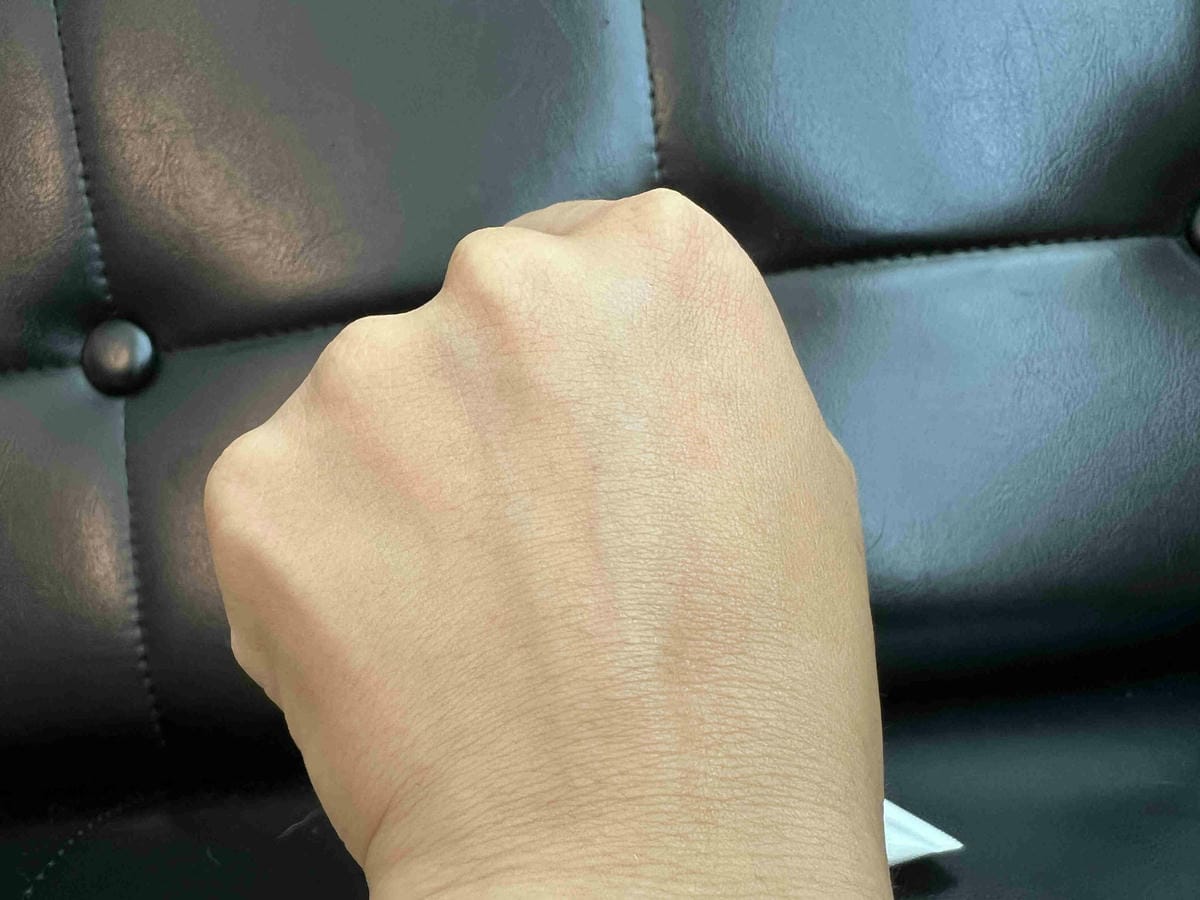 Venus Skin-粉刺痘痘雙殺組 (1).jpg Venus Skin-粉刺痘痘雙殺組 (1).jpg