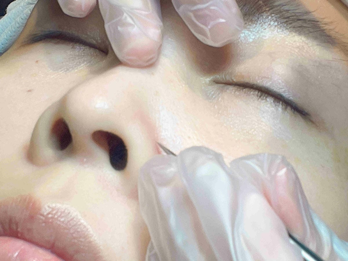 皮膚專家 (56).jpg 皮膚專家 (56).jpg