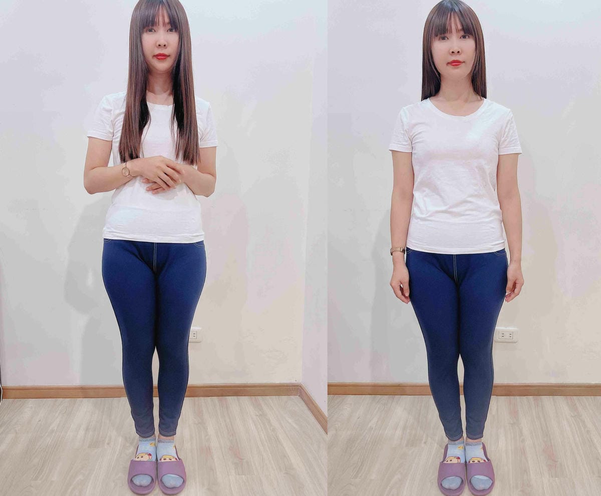 建頤整復 (10).jpg 建頤整復 (10).jpg